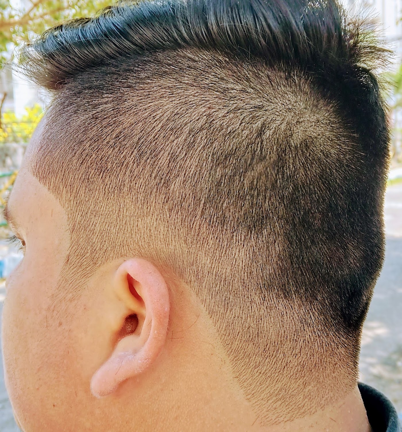 Sharp skin fade